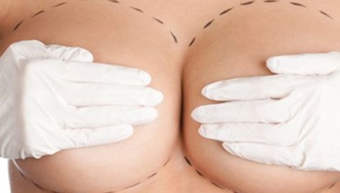 Chirurgia estetica seno