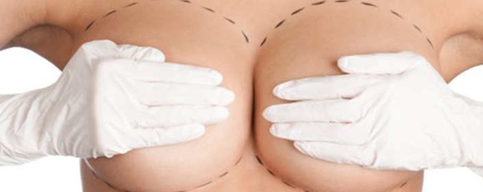 Chirurgia estetica seno