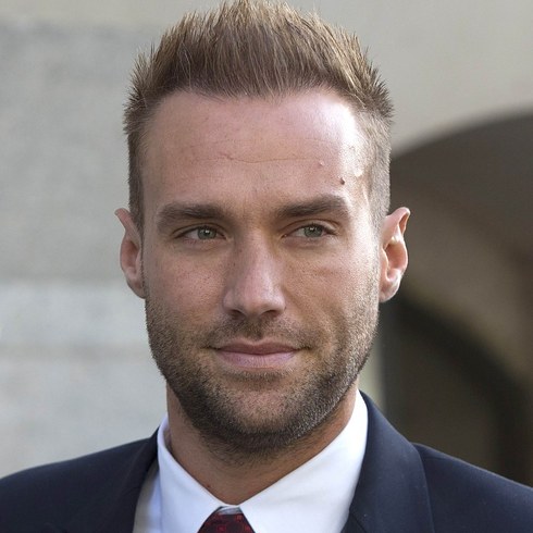 Trapianto capelli Vip Calum Best 02