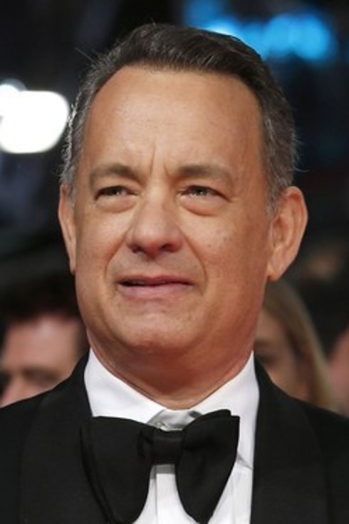 Trapianto capelli Vip Tom Hanks 02