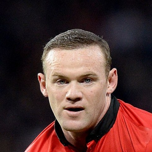 Trapianto capelli Vip Wayne Rooney 02